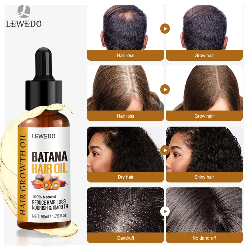 Batana Oil Hair Growth Serum - Fast Growing Anti-Hair Loss Treatment | Natural Repair for Damaged Hair