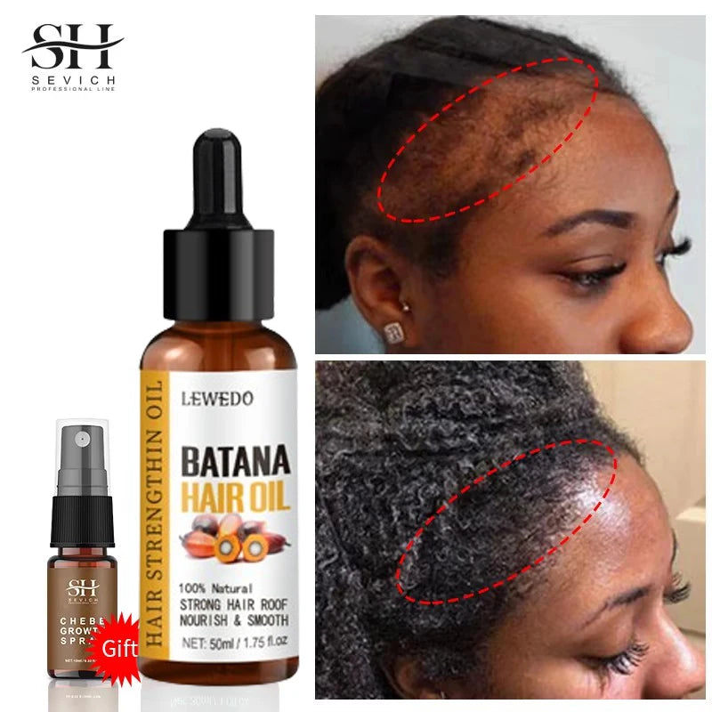 Batana Oil Hair Growth Serum - Fast Growing Anti-Hair Loss Treatment | Natural Repair for Damaged Hair
